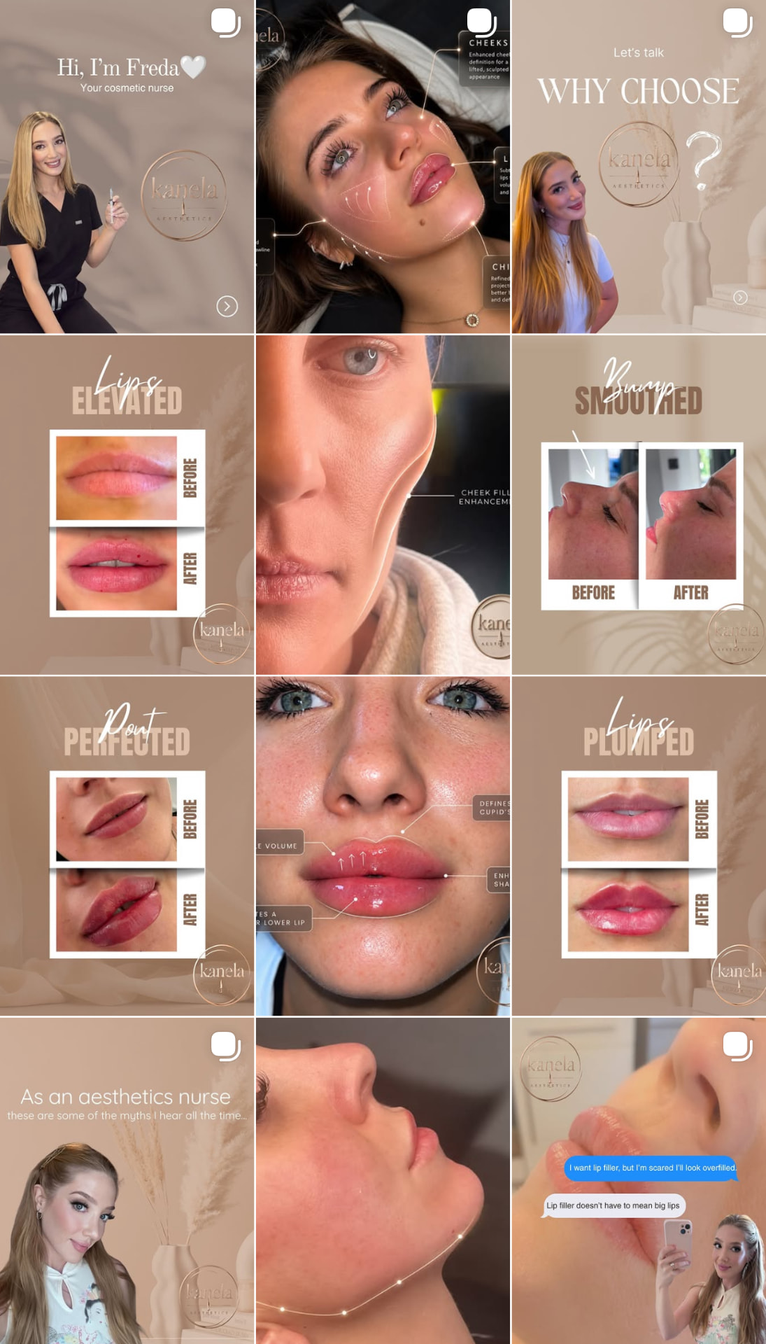 Kanela Aesthetics project preview